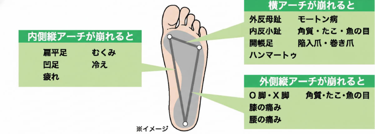 偏平足・外反母趾などのトラブル