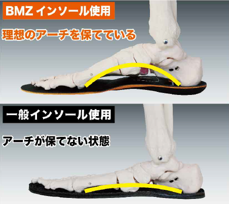 ”立方骨”を支えて、足本来の動きをサポートする