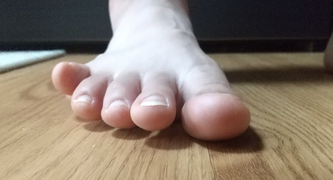 コラム４】あなたの足の指、地面についていますか？ ～浮き指 