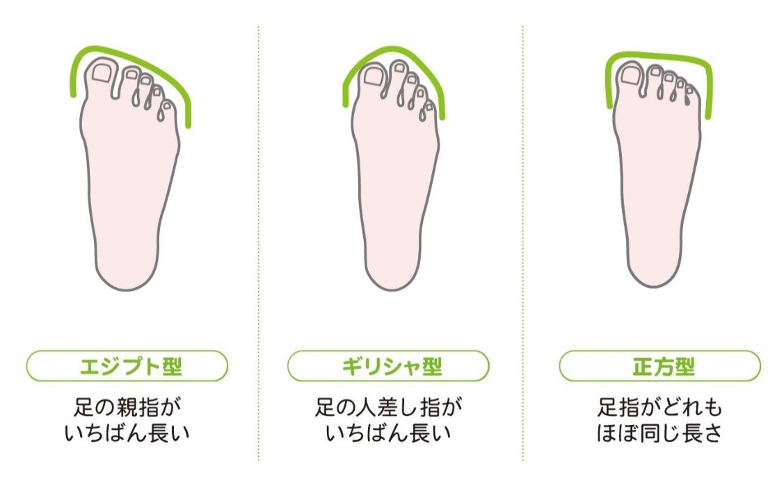 コラム２ あなたの足の親指 曲がっていませんか 外反母趾 インソールで足から健康な体を作るbmz